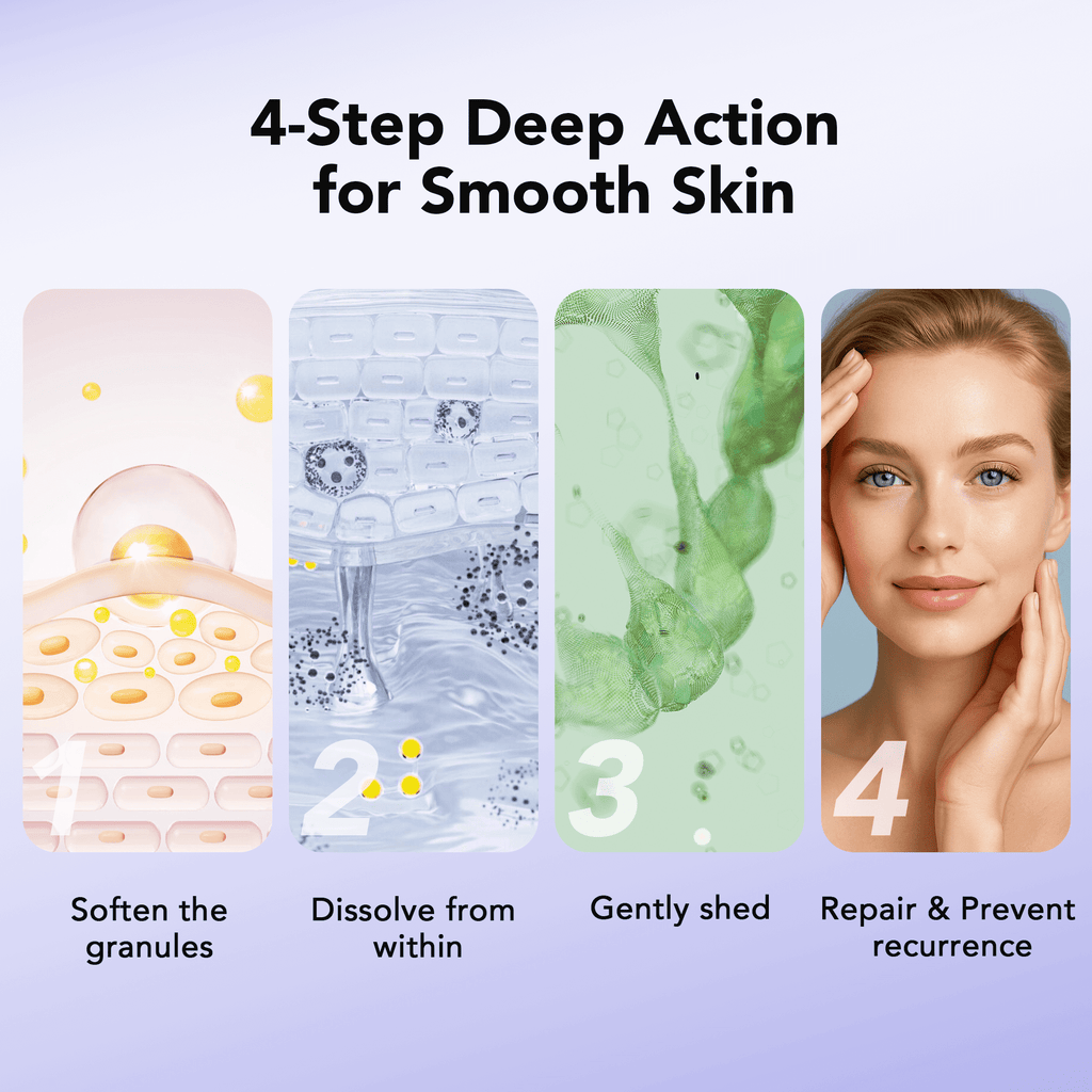 30 mL Treatment, Milia Spot Treatment with Salicylic Acid Milia Acne Serum Clearing Skin Essence
