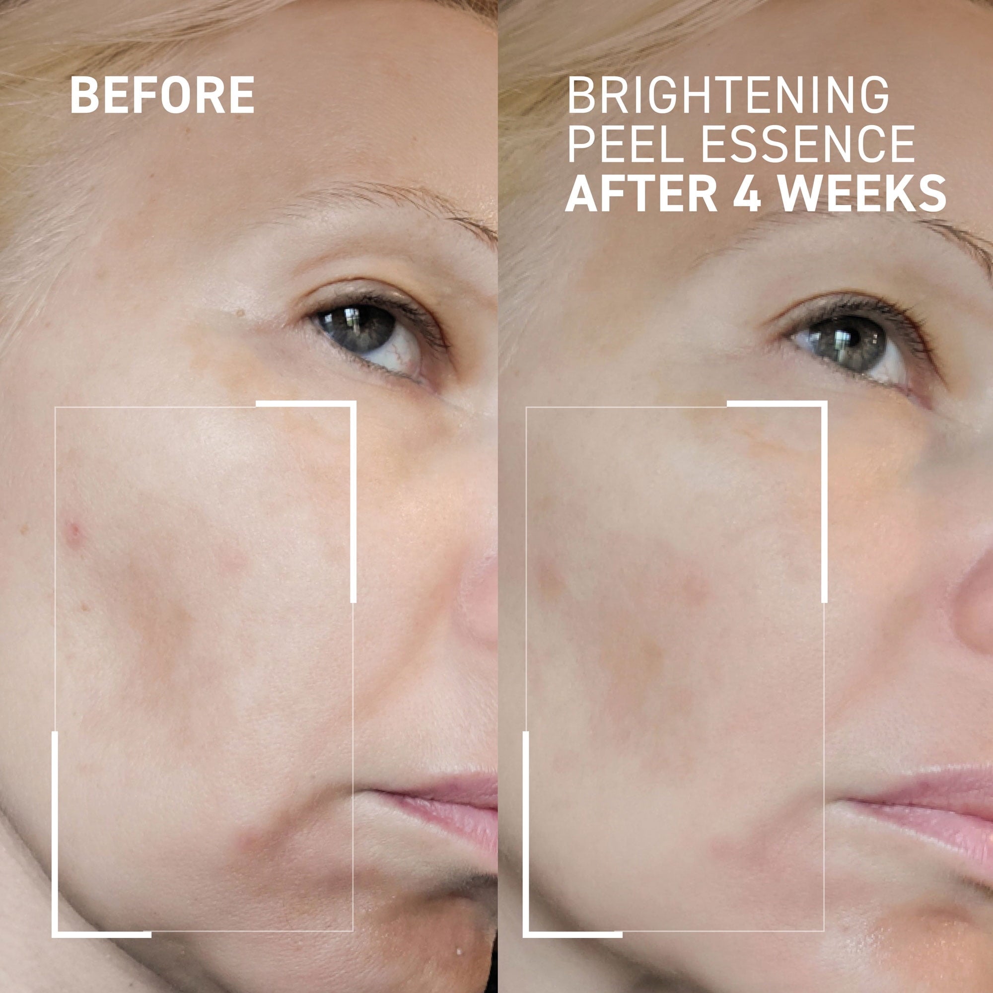 Dr. Brandt Dr. B Lab. Brightening Peel Essence 100 ml