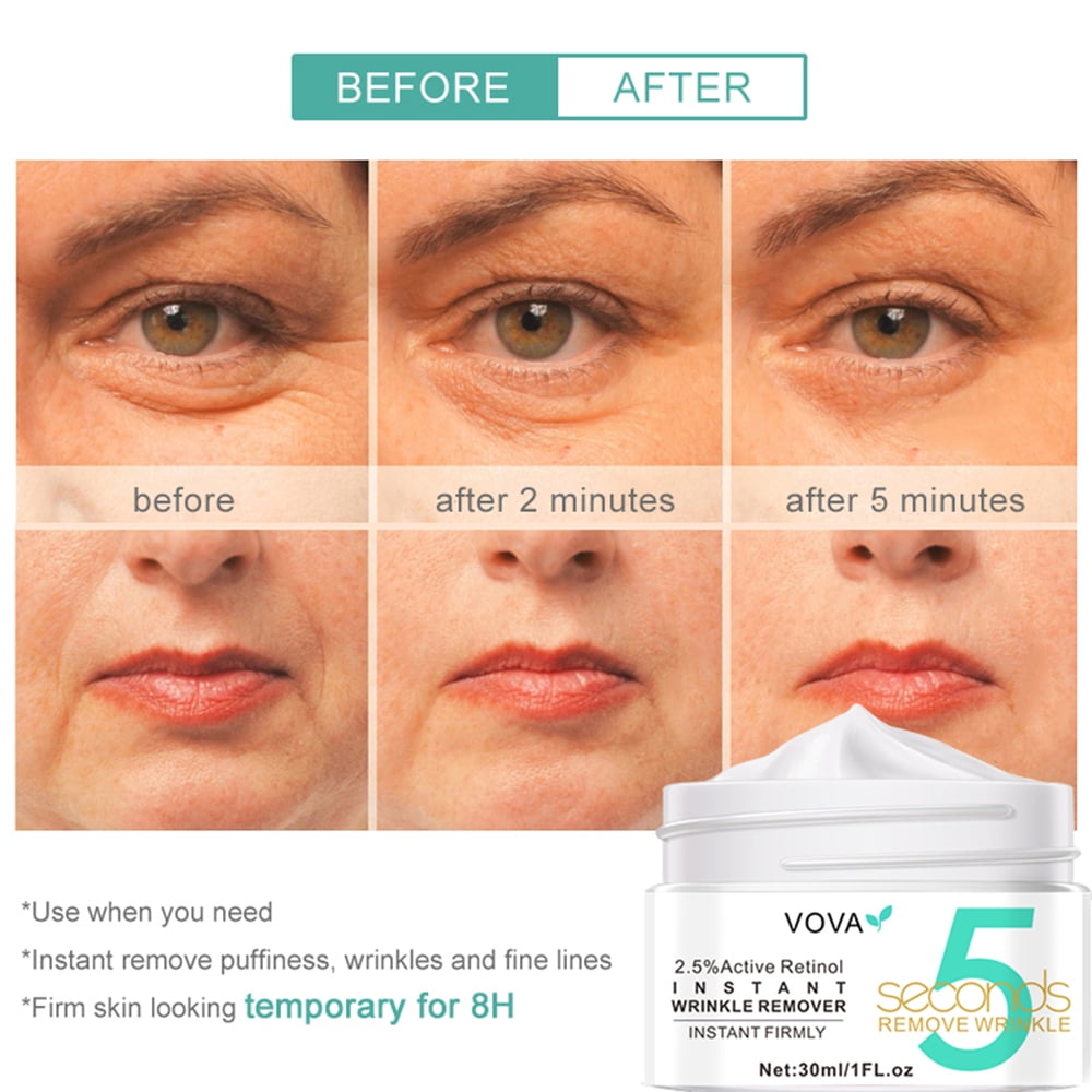 for - 5 Seconds Instant Effect, Anti Aging Fade Wrinkle Fast Absorption Expertise Wrinkle Remover Cream Face Essence Cream, 1oz