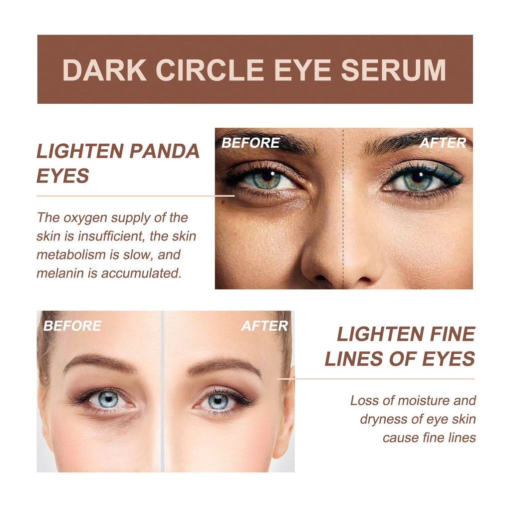 Firming Serum,Aging Eye Serums For Women & Men - Reduces Puffiness, Dark Circles, Under Eye Bags, Wrinkles And Fine Lines Around The Eyes20ML Essence Personal Care Clearance A