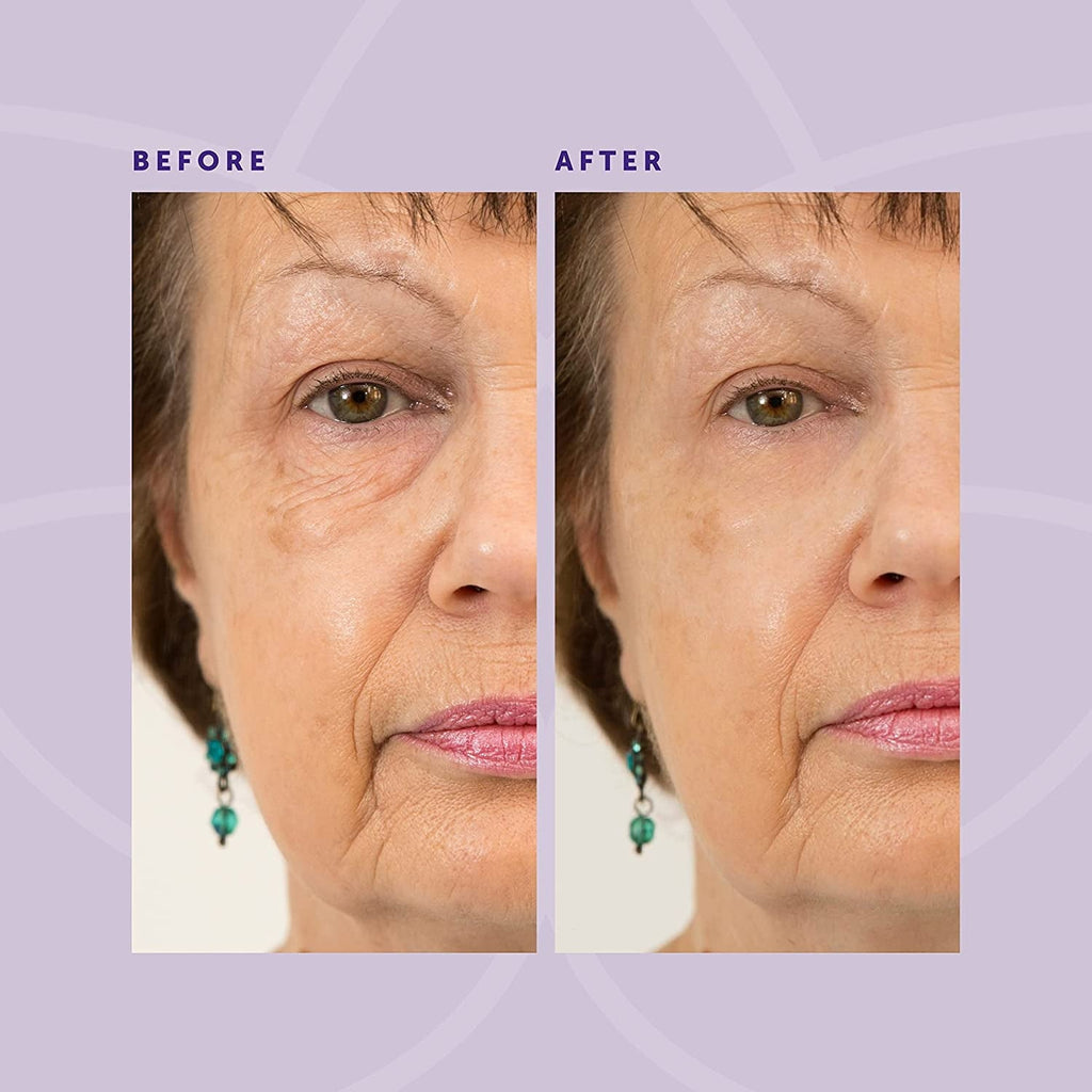 for - 5 Seconds Instant Effect, Anti Aging Fade Wrinkle Fast Absorption Expertise Wrinkle Remover Cream Face Essence Cream, 1oz