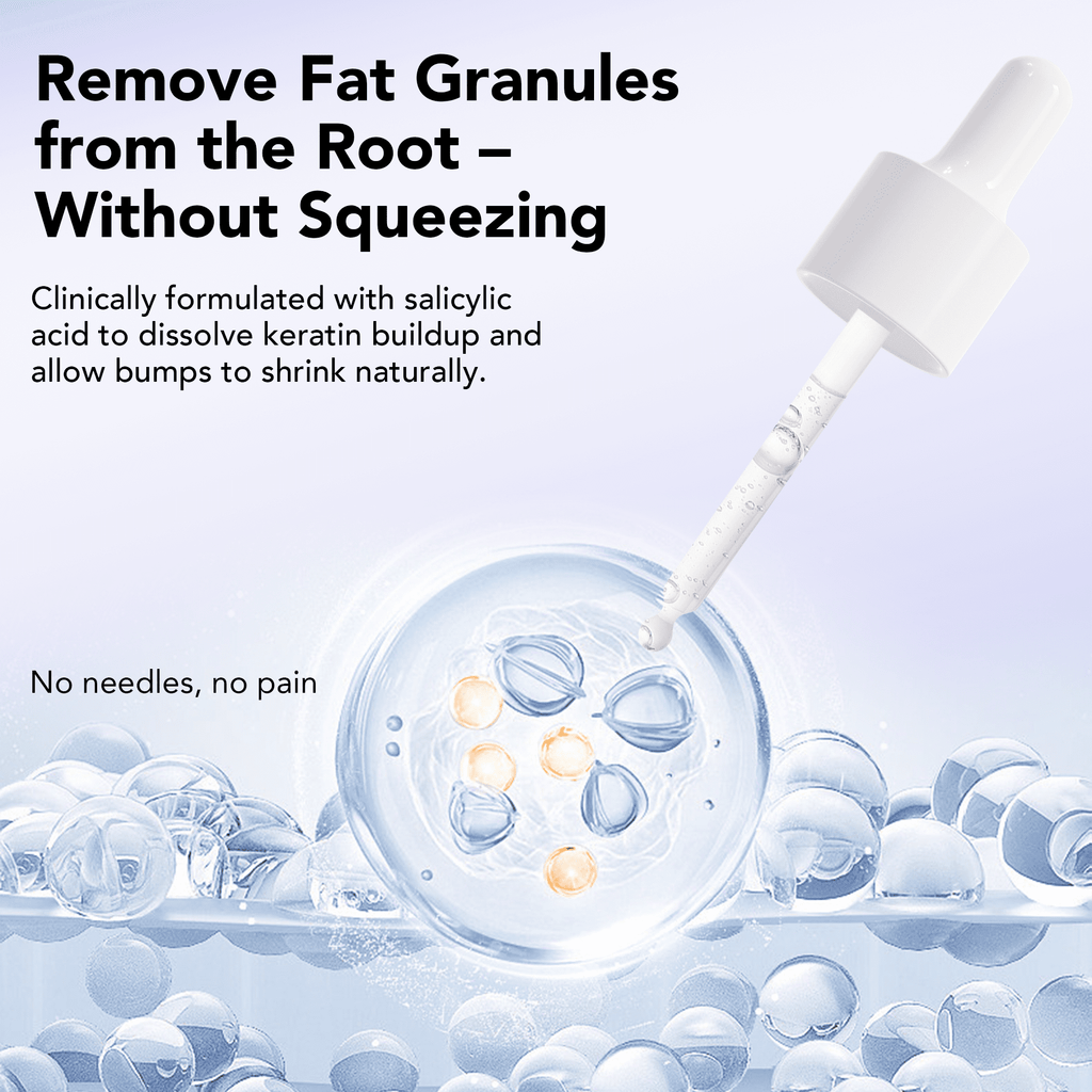 30 mL Treatment, Milia Spot Treatment with Salicylic Acid Milia Acne Serum Clearing Skin Essence