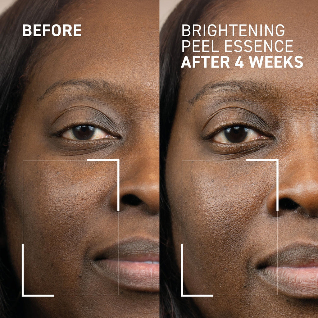 Dr. Brandt Dr. B Lab. Brightening Peel Essence 100 ml