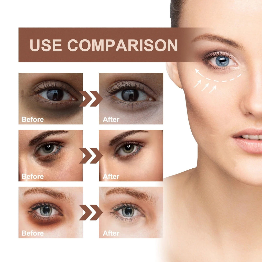Firming Serum,Aging Eye Serums For Women & Men - Reduces Puffiness, Dark Circles, Under Eye Bags, Wrinkles And Fine Lines Around The Eyes20ML Essence Personal Care Clearance A