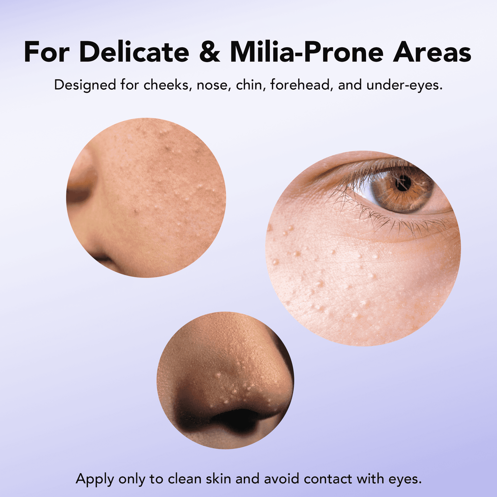 30 mL Treatment, Milia Spot Treatment with Salicylic Acid Milia Acne Serum Clearing Skin Essence