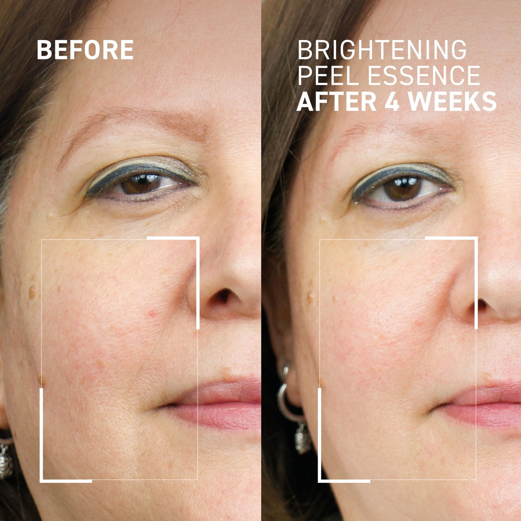 Dr. Brandt Dr. B Lab. Brightening Peel Essence 100 ml